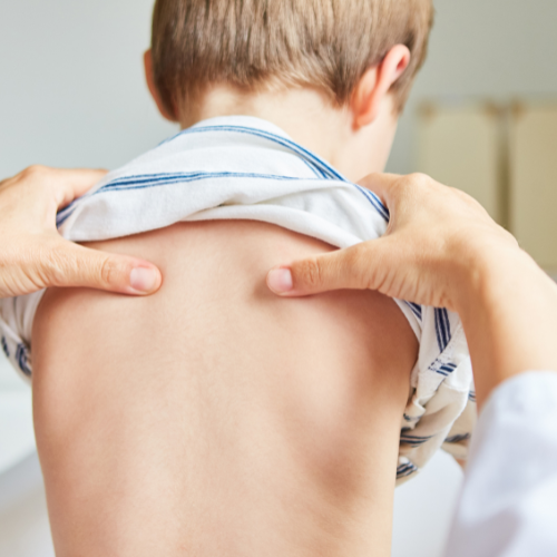 osteopatia per plagiocefalia infantile a Limbiate